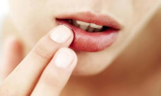 4 thói quen dễ làm tăng nguy cơ ung thư miệng